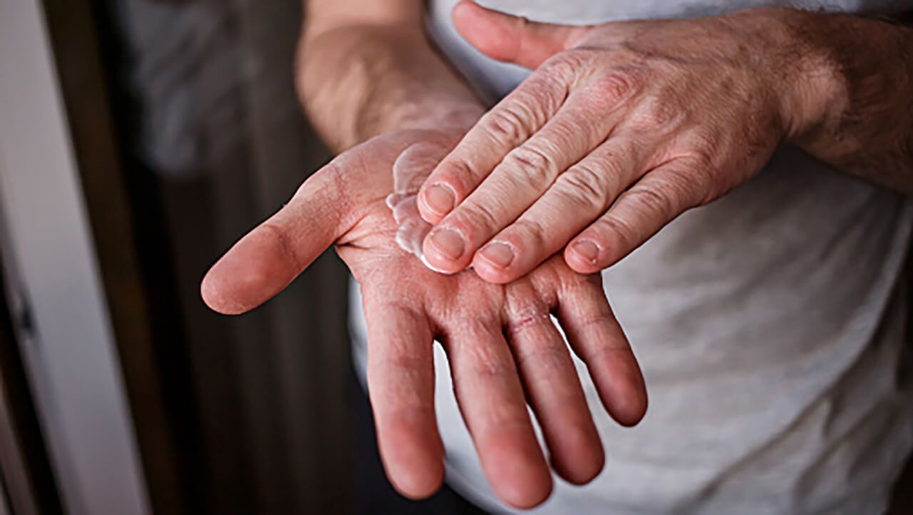 Ruke koje utrljavaju kremu